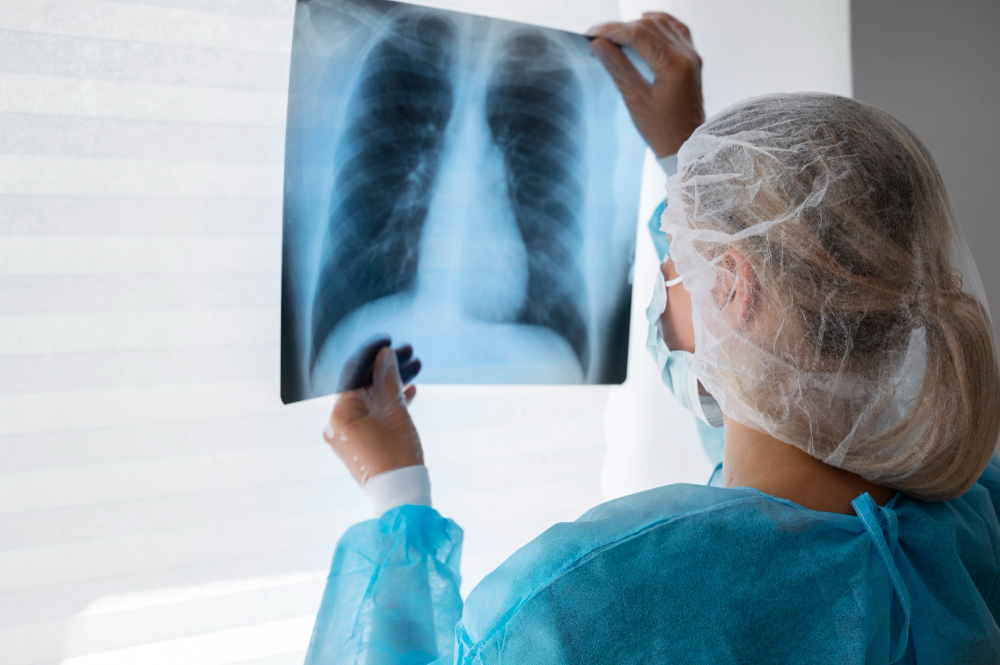 Yumşaq toxuma sarkomalarının multidissiplinar diaqnostika və müalicə alqoritmi